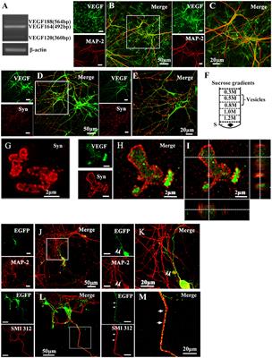 VEGF <mark class="highlighted">Axonal Transport</mark> Dependent on Kinesin-1B and Microtubules Dynamics